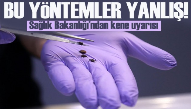 Sağlık Bakanlığı'ndan kene uyarısı! Bu yöntemleri denemeyin!