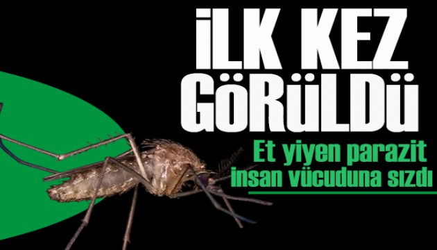 ABD’de ilk kez görüldü: Et yiyen parazit insan vücuduna sızdı
