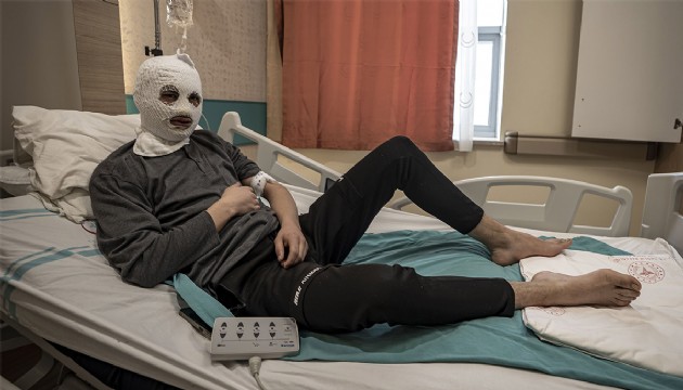 Çakmak gazı tüpü elinde patladı