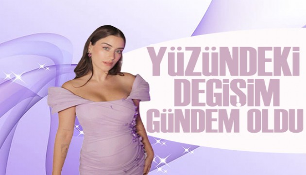 Hazal Kaya'nın yüzündeki değişim gündem oldu