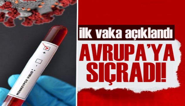Maymun çiçeği virüsü Avrupa'ya sıçradı: İlk vaka görüldü