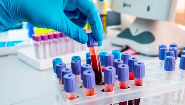 B kan grubuna sahip olanlar dikkat! O hastalığın riskini yüzde 28 artırıyormuş