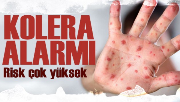 DSÖ uyardı: 31 ülkede kolera alarmı!